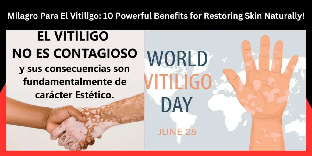 Milagro Para El Vitiligo